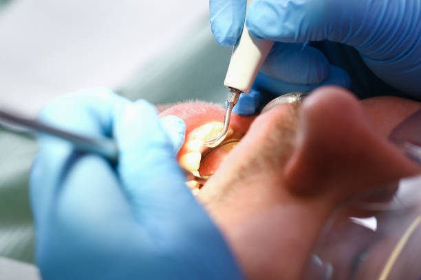 Best Tooth Pain Emergency Relief  in Munroe Falls, OH
