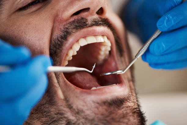 Best Dentist Open Late Near Me  in Munroe Falls, OH